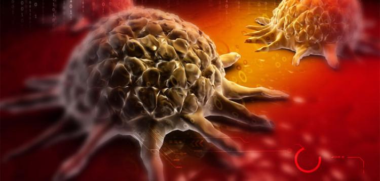 1539117461 cancer cell